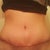 2 wks 5 days