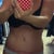 7 weeks PO. Still have swelling in my hips...