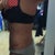 7 weeks PO. Side view