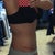 7 weeks PO. Left side.