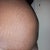 Stomach after 2 C-sections...gotta love the kids...