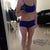 In the morning. A little less swollen than in the evening but still not totally flat.