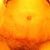 My new "cosmetic" belly button!
