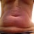 Found a better before pic of loose skin.