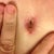 Belly button isn't looking good.