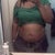 Front View Me 1 week before surgery I hope my natural curvy shape shows after this surgery!
