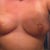 2 weeks post