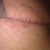 18 days after