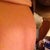 Random swelling in upper abdomen!