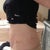 Three weeks post surgery