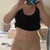 Three weeks post surgery