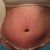 week 1 post op