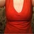 This is about 7 months post op, taken December 4, 2010. I am so happy compared to before...