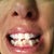 original teeth