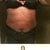 BEFORE - Muffin top w/jeans