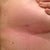 Lipo incision under right breast - Post Op Day 28