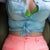 You can still see the discoloration on my stomach 8 months later..
