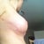 post-op day 23, right breast. This lateral point is healing faster. It no longer sticks out, which I'm really pleased about! One day, I just woke up and it had naturally started poking "in" instead. I think it's going to eventually just blend with my skin.