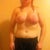eight weeks post op