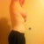 eight weeks post op