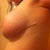 eight weeks post op
