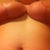 eight weeks post op