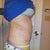 3.5wks PO