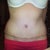 4wks PO