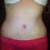 4wks PO
