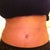 Belly button not looking bad.  Start the marble trick this weekend :)