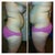 Before right and left side view