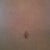 belly button 4 months