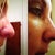 Day seven. See the difference in the tip