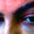 AFTER TREATMENT eyes