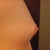 Side view before. I've never like the 'cone' like shape