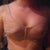 Day of surgery.  Blood is from mole removal sure hopes it comes out I want to keep this sexy number lol