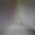 Bruise on sternum swelling starting to go down