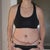 WTH?! That scar line kinda looks like a graph of my weight loss over time...except for the rise on the right/my left! (LOL)