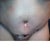 Super swollen!  My belly button is soooo off center.  I hope it corrects itself once the swelling goes away!  =(