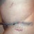 A small part of the tape came off and my scar is minimal!