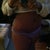 As of today  I'm 7 months! So far so good! Still have a little swelling and numbness!
