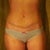 22 day PO. still have some swelling but my waist is fine and my muscles can do without CG now, though I will continue to wear it not to loose my results