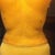 2 months Post lipo