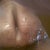 Close up of incision at 4 weeks post op..just put oil on it. Still swollen but going down