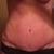 7 wks incision