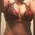 This is me now at 10 Mos PO. Pre-revision. Dr. Walker is going to shoot to get rid of all this extra fat and revise the scar so its hidden under this bathing suit.
