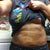 2 weeks post op