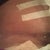 Scar healing nicely at 3 weeks PO. Dr. Robles did the darn thang! My scar is very thin and very low!!! Excellent!!