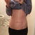 belly two days before. I think I've done as much as I can, the rest is up to Dr. T!