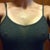 5 months post op